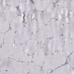 KIF13B Antibody, Novus Biologicals 25 &mu;L; Unlabeled:Antibodies, Polyclonal