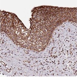 KIF14 Antibody, Novus Biologicals 0.1mL; Unlabeled:Antibodies, Polyclonal