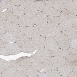 KIF15 Antibody, Novus Biologicals 0.1mL; Unlabeled:Antibodies, Polyclonal