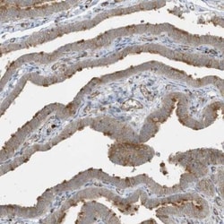 KIF15 Antibody, Novus Biologicals 25 &mu;L | Buy Online | Novus Biologicals | Fisher Scientific