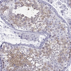 KIF17 Antibody, Novus Biologicals 0.1mL; Unlabeled:Antibodies, Polyclonal