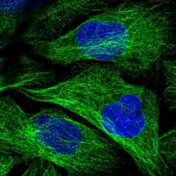 KIF18A Antibody, Novus Biologicals:Antibodies:Primary Antibodies