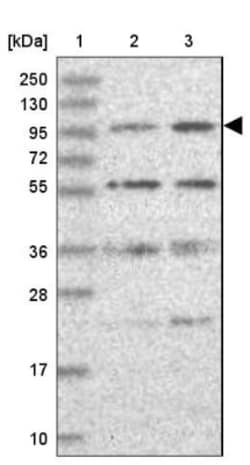 KIF18A Antibody, Novus Biologicals:Antibodies:Primary Antibodies