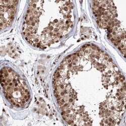KIF20A Antibody, Novus Biologicals:Antibodies:Primary Antibodies