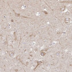 KIF21A Antibody, Novus Biologicals 25 &mu;L, Unlabeled:Antibodies, Polyclonal