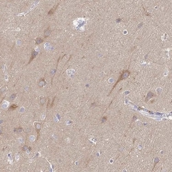 KIF21A Antibody, Novus Biologicals 25 &mu;L, Unlabeled:Antibodies, Polyclonal