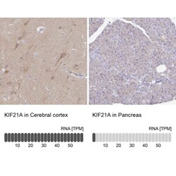 KIF21A Antibody, Novus Biologicals 25 &mu;L, Unlabeled:Antibodies, Polyclonal