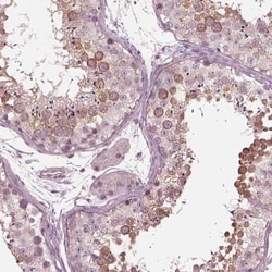 KIF6 Antibody, Novus Biologicals 25 &mu;L; Unlabeled:Antibodies, Polyclonal