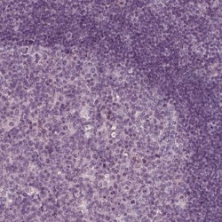 KIF6 Antibody, Novus Biologicals 25 &mu;L; Unlabeled:Antibodies, Polyclonal