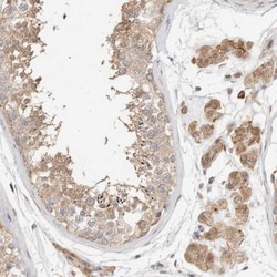 KIF9 Antibody, Novus Biologicals 0.1mL; Unlabeled:Antibodies, Polyclonal
