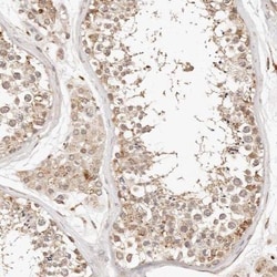 KIF9 Antibody, Novus Biologicals 0.1mL; Unlabeled:Antibodies, Polyclonal