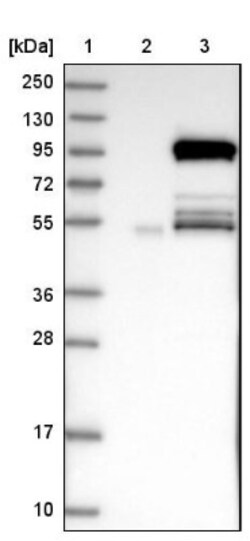 KIF9 Antibody, Novus Biologicals 0.1mL; Unlabeled:Antibodies, Polyclonal