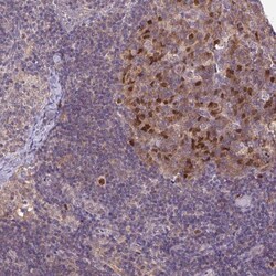 KIFC1 Antibody, Novus Biologicals 25 &mu;L; Unlabeled:Antibodies, Polyclonal