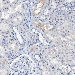 KIFC3 Antibody, Novus Biologicals 25 &mu;L | Buy Online | Novus Biologicals | Fisher Scientific