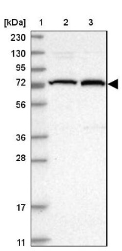KIFC3 Antibody, Novus Biologicals 25 &mu;L | Buy Online | Novus Biologicals | Fisher Scientific