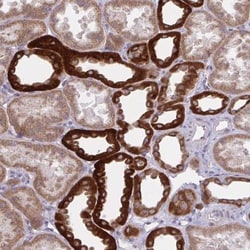 KIR5.1 Antibody, Novus Biologicals 0.1mL; Unlabeled:Antibodies, Polyclonal