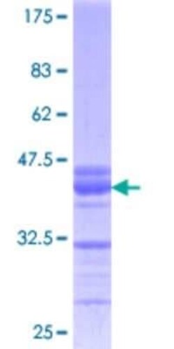 Novus Biologicals Recombinant Human KLF10 GST (N-Term) Protein 25 &mu;g | Buy Online | Novus Biologicals&trade; | Fisher Scientific