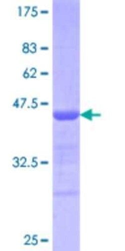Novus Biologicals Recombinant Human KLF10 GST (N-Term) Protein 10 &mu;g | Buy Online | Novus Biologicals&trade; | Fisher Scientific