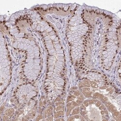 KLF2 Antibody, Novus Biologicals:Antibodies:Primary Antibodies