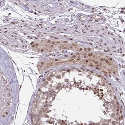 KLF2 Antibody, Novus Biologicals:Antibodies:Primary Antibodies