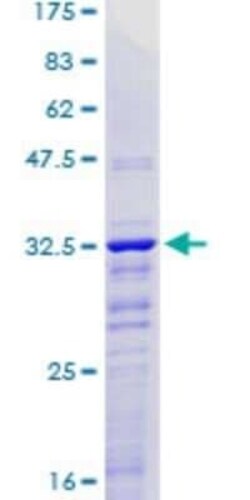 Novus Biologicals Recombinant Human KLF2 GST (N-Term) Protein 25 &mu;g | Buy Online | Novus Biologicals&trade; | Fisher Scientific