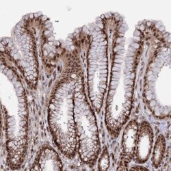 KLF5 Antibody, Novus Biologicals 0.1mL; Unlabeled:Antibodies, Polyclonal