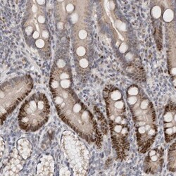 KLF7 Antibody, Novus Biologicals 0.1mL; Unlabeled:Antibodies, Polyclonal