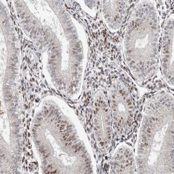 KLF7 Antibody, Novus Biologicals 0.1mL; Unlabeled:Antibodies, Polyclonal