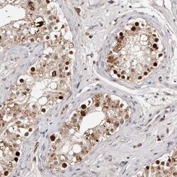 KLF7 Antibody, Novus Biologicals 0.1mL; Unlabeled:Antibodies, Polyclonal
