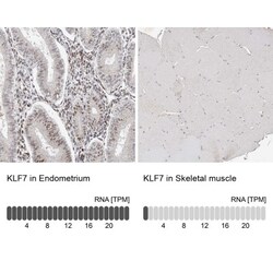 KLF7 Antibody, Novus Biologicals 0.1mL; Unlabeled:Antibodies, Polyclonal