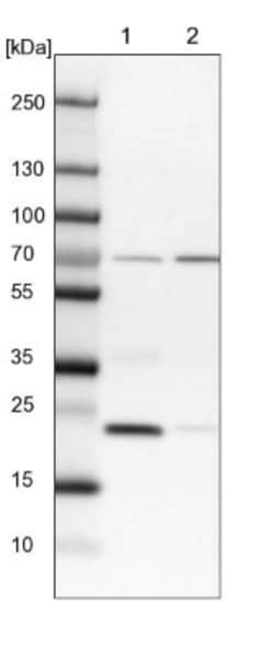KLHDC10 Antibody, Novus Biologicals:Antibodies:Primary Antibodies