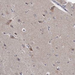 KLHDC3 Antibody, Novus Biologicals 0.1mL; Unlabeled:Antibodies, Polyclonal