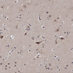 KLHDC3 Antibody, Novus Biologicals 25 &mu;L; Unlabeled:Antibodies, Polyclonal