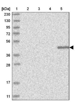 KLHDC3 Antibody, Novus Biologicals 0.1mL; Unlabeled:Antibodies, Polyclonal