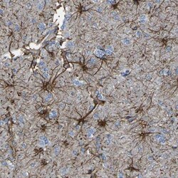 KLHDC8B Antibody, Novus Biologicals 0.1mL; Unlabeled:Antibodies, Polyclonal