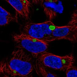 KLHL15 Antibody, Novus Biologicals 0.1mL; Unlabeled:Antibodies, Polyclonal