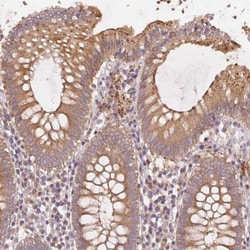 KLHL15 Antibody, Novus Biologicals 0.1mL; Unlabeled:Antibodies, Polyclonal