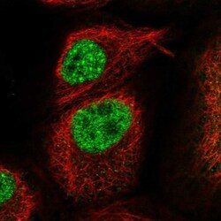 KLHL17 Antibody, Novus Biologicals:Antibodies:Primary Antibodies