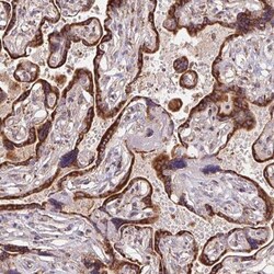 KLHL20 Antibody, Novus Biologicals 25 &mu;L, Unlabeled:Antibodies, Polyclonal