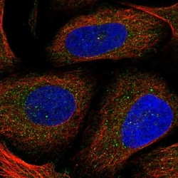 KLHL32 Antibody, Novus Biologicals 25 &mu;L, Unlabeled:Antibodies, Polyclonal