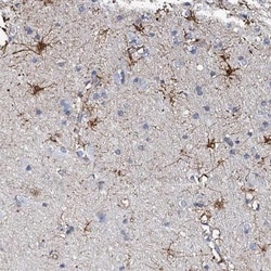KLHL32 Antibody, Novus Biologicals 25 &mu;L, Unlabeled:Antibodies, Polyclonal
