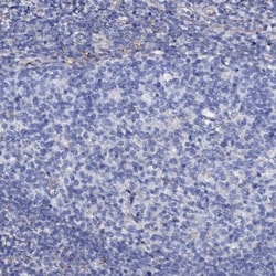 KLHL32 Antibody, Novus Biologicals 25 &mu;L, Unlabeled:Antibodies, Polyclonal