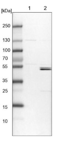 KLHL7 Antibody, Novus Biologicals 0.1mL; Unlabeled:Antibodies, Polyclonal