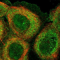 KMT2D Antibody, Novus Biologicals 0.1mL; Unlabeled:Antibodies, Polyclonal