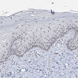 KMT2D Antibody, Novus Biologicals 0.1mL; Unlabeled:Antibodies, Polyclonal