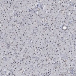 KMT2D Antibody, Novus Biologicals 0.1mL; Unlabeled:Antibodies, Polyclonal