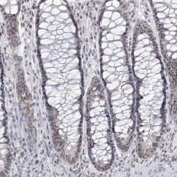 KMT2D Antibody, Novus Biologicals 0.1mL; Unlabeled:Antibodies, Polyclonal