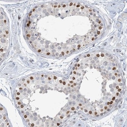 KMT2D Antibody, Novus Biologicals 0.1mL; Unlabeled:Antibodies, Polyclonal