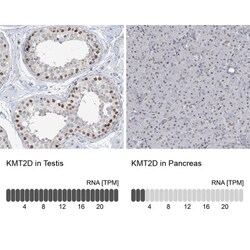 KMT2D Antibody, Novus Biologicals 0.1mL; Unlabeled:Antibodies, Polyclonal