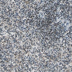 KNL-2 Antibody, Novus Biologicals 0.1mL; Unlabeled:Antibodies, Polyclonal